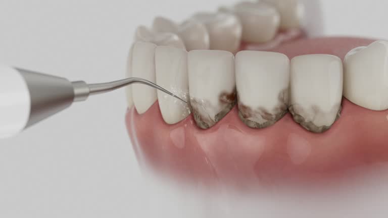 Trusted Teeth Cleaning And Checkup service in West Mifflin, PA - Dentist Open Now